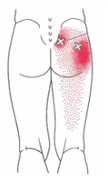 hip pain sciatic treatment marpole
