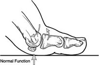 stiff toe pain treatment richmond