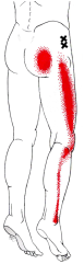 hip and leg pain piriformis cure