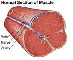 muscle strain richmond physiotherapy